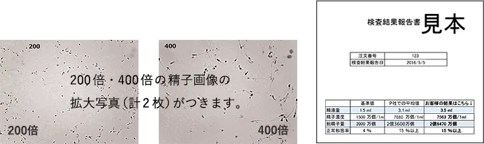 検査／納品項目：精液量あり、精子濃度あり、総精子数あり、精子正常形態率あり、精子画像あり