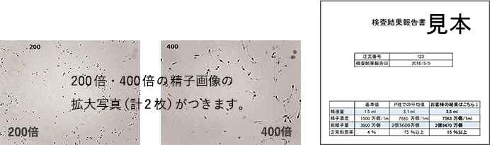 200倍・400倍の精子画像の拡大写真（計2枚）がつきます。